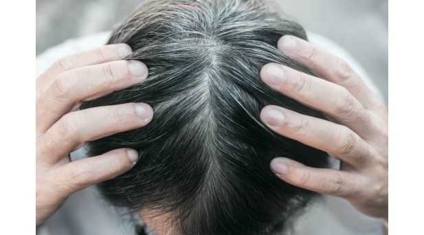 Capelli bianchi nell'uomo: davvero arrivano prima?